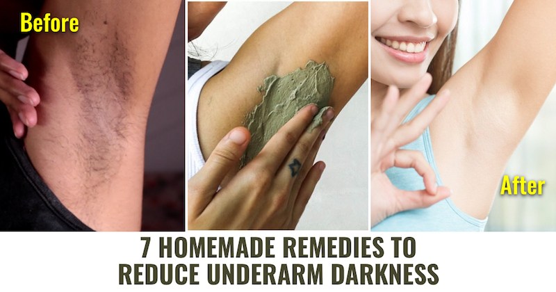 7 Residence Cures to Scale back Underarm Darkness 7 Residence Cures to Scale back Underarm Darkness